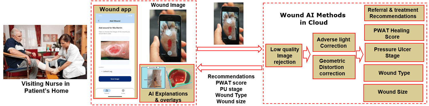 SmartWAnDS - AI-driven Wound Assessment and Decision Support System